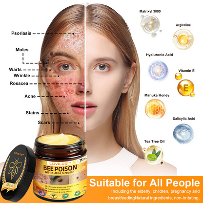 [𝐎𝐟𝐟𝐢𝐜𝐢𝐚𝐥 𝐁𝐫𝐚𝐧𝐝 𝐒𝐭𝐨𝐫𝐞] 🐝 LOVILDS™ 𝐁𝐞𝐞 𝐕𝐞𝐧𝐨𝐦 𝐀𝐥𝐥-𝐢𝐧-𝐎𝐧𝐞 𝐂𝐫𝐞𝐚𝐦 (👩‍⚕️ 𝐀𝐦𝐞𝐫𝐢𝐜𝐚𝐧 𝐀𝐜𝐚𝐝𝐞𝐦𝐲 𝐨𝐟 𝐃𝐞𝐫𝐦𝐚𝐭𝐨𝐥𝐨𝐠𝐲 𝟐𝟎𝟐𝟓 𝐒𝐩𝐞𝐜𝐢𝐚𝐥𝐥𝐲 𝐑𝐞𝐜𝐨𝐦𝐦𝐞𝐧𝐝𝐞𝐝 𝐏𝐫𝐨𝐝𝐮𝐜𝐭)