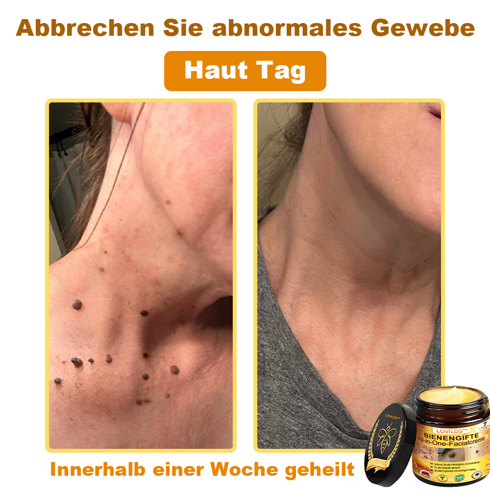 [offizieller Markenshop] 🐝 LOVILDS™ Bienengift-All-Action-Creme (👩‍⚕️ Deutsche Dermatologische Gesellschaft e.V. 𝟐𝟎𝟐𝟓Besonders empfehlenswerte Produkte).