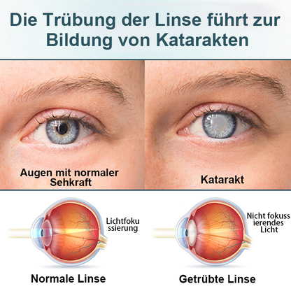 LOVILDS® OptiFusion Nano Augentropfen-Serum（3)