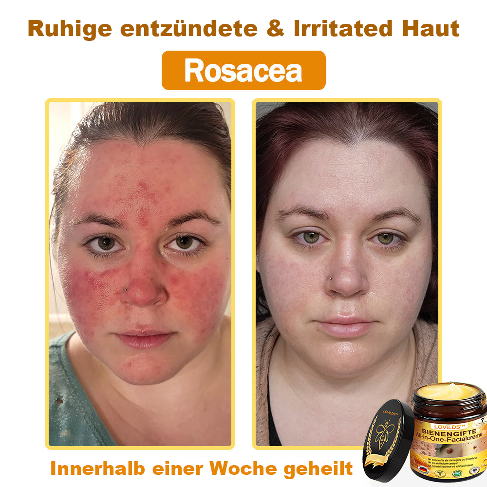 [offizieller Markenshop] 🐝 LOVILDS™ Bienengift-All-Action-Creme (👩‍⚕️ Deutsche Dermatologische Gesellschaft e.V. 𝟐𝟎𝟐𝟓Besonders empfehlenswerte Produkte).