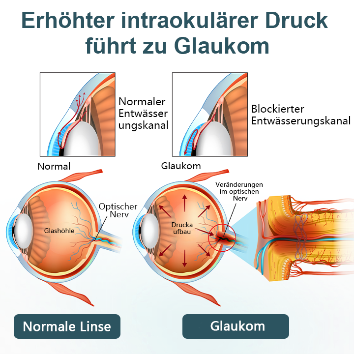 LOVILDS® OptiFusion Nano Augentropfen-Serum（3)