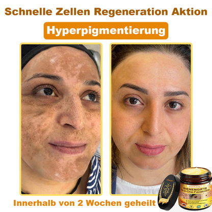 [offizieller Markenshop] 🐝 LOVILDS™ Bienengift-All-Action-Creme (👩‍⚕️ Deutsche Dermatologische Gesellschaft e.V. 𝟐𝟎𝟐𝟓Besonders empfehlenswerte Produkte).