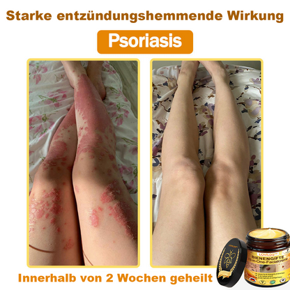 [offizieller Markenshop] 🐝 LOVILDS™ Bienengift-All-Action-Creme (👩‍⚕️ Deutsche Dermatologische Gesellschaft e.V. 𝟐𝟎𝟐𝟓Besonders empfehlenswerte Produkte).
