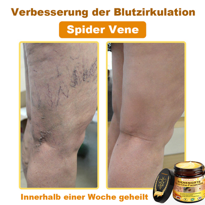 [offizieller Markenshop] 🐝 LOVILDS™ Bienengift-All-Action-Creme (👩‍⚕️ Deutsche Dermatologische Gesellschaft e.V. 𝟐𝟎𝟐𝟓Besonders empfehlenswerte Produkte).
