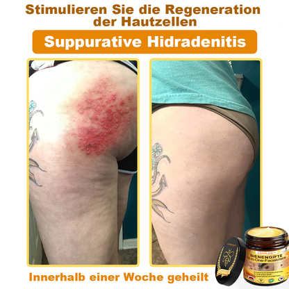 [offizieller Markenshop] 🐝 LOVILDS™ Bienengift-All-Action-Creme (👩‍⚕️ Deutsche Dermatologische Gesellschaft e.V. 𝟐𝟎𝟐𝟓Besonders empfehlenswerte Produkte).